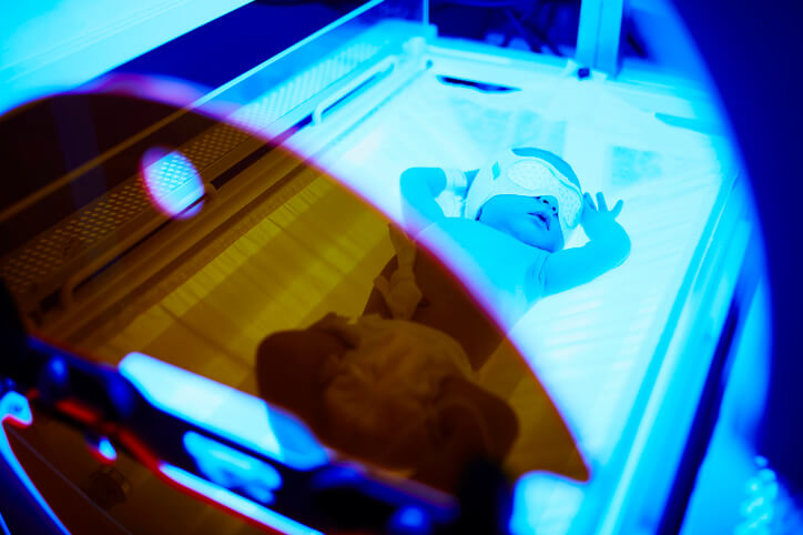 Gulsot - lysbehandling af nyfødt