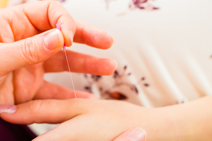 Jordmoder giver akupunktur på kvinde under fødslen (i hånden)