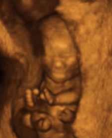 Fra 3D scanning i uge 12+. Baby i livmoderen med ansigt, hænder og fødder ud mod dig.
