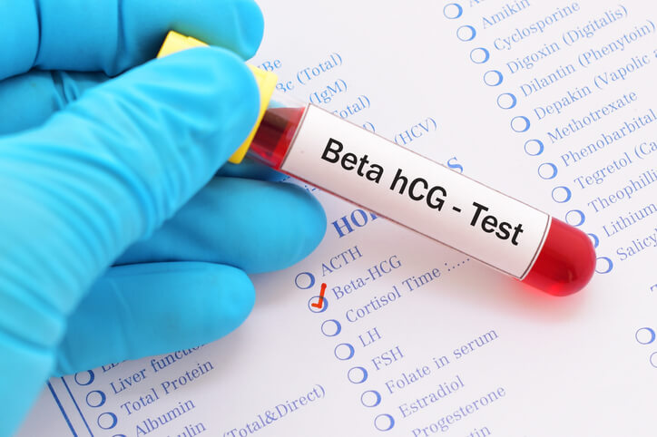 Blodprøve til bestemmelse af HCG i forbindelse med graviditet