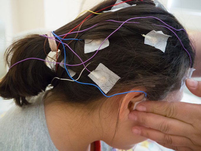 Pige med EEg elektroder på hovedet - hjernebølger og søvn