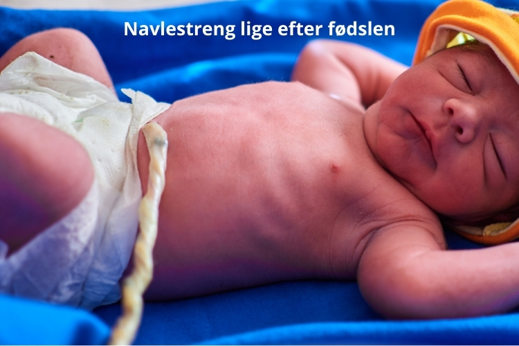 navlestreng nyfødt (1)